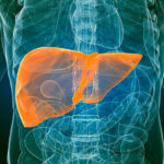 Первые признаки и симптомы цирроза печени Первые признаки и симптомы цирроза печени